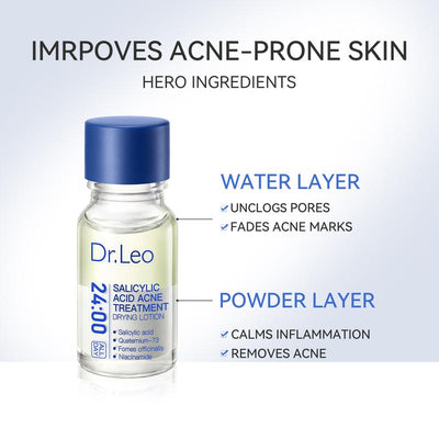 Salicylic Acid Acne Treatment