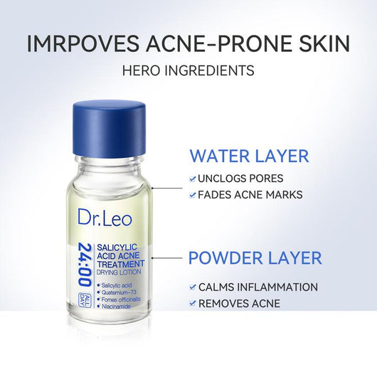 Salicylic Acid Acne Treatment