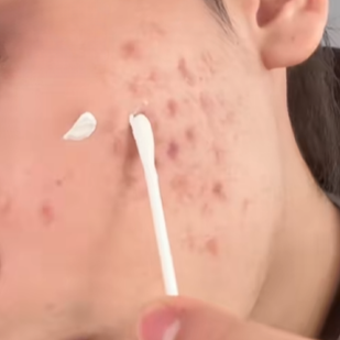 Dab It On Before Bed